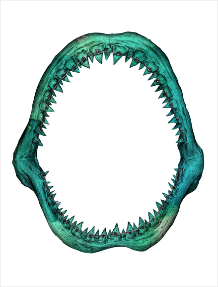 Braces Art Print by TenTimesKarma